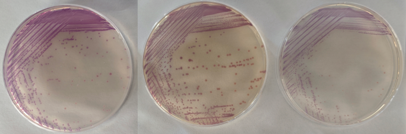 沙門(mén)檢測新助手—沙門(mén)氏+顯色培養基