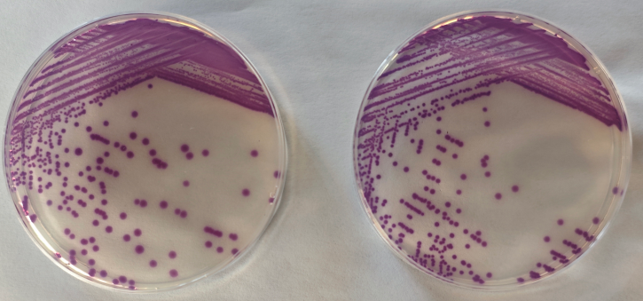 沙門(mén)檢測新助手—沙門(mén)氏+顯色培養基
