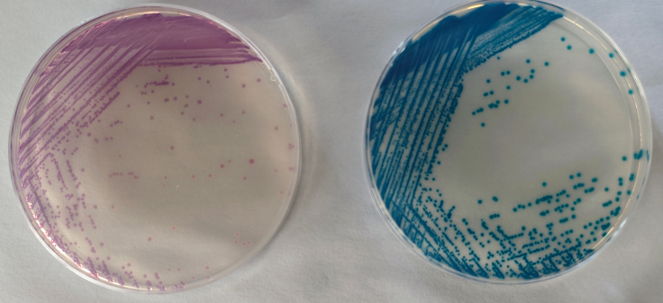 沙門(mén)檢測新助手—沙門(mén)氏+顯色培養基